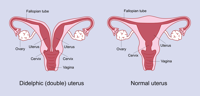 If your uterus is didelphic, it means that uterus womb is split in two.