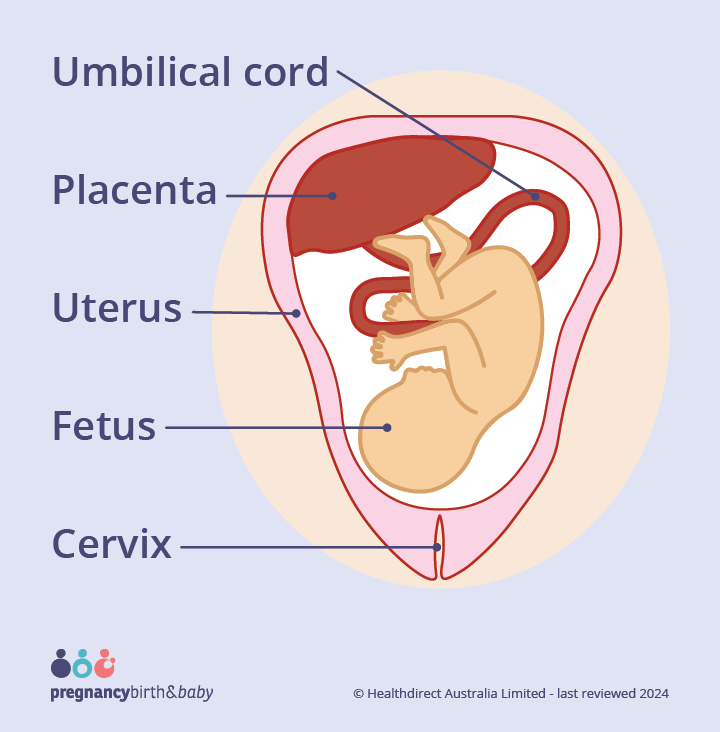 This image shows a normal placental location, with the placenta attached at the top of the uterus.