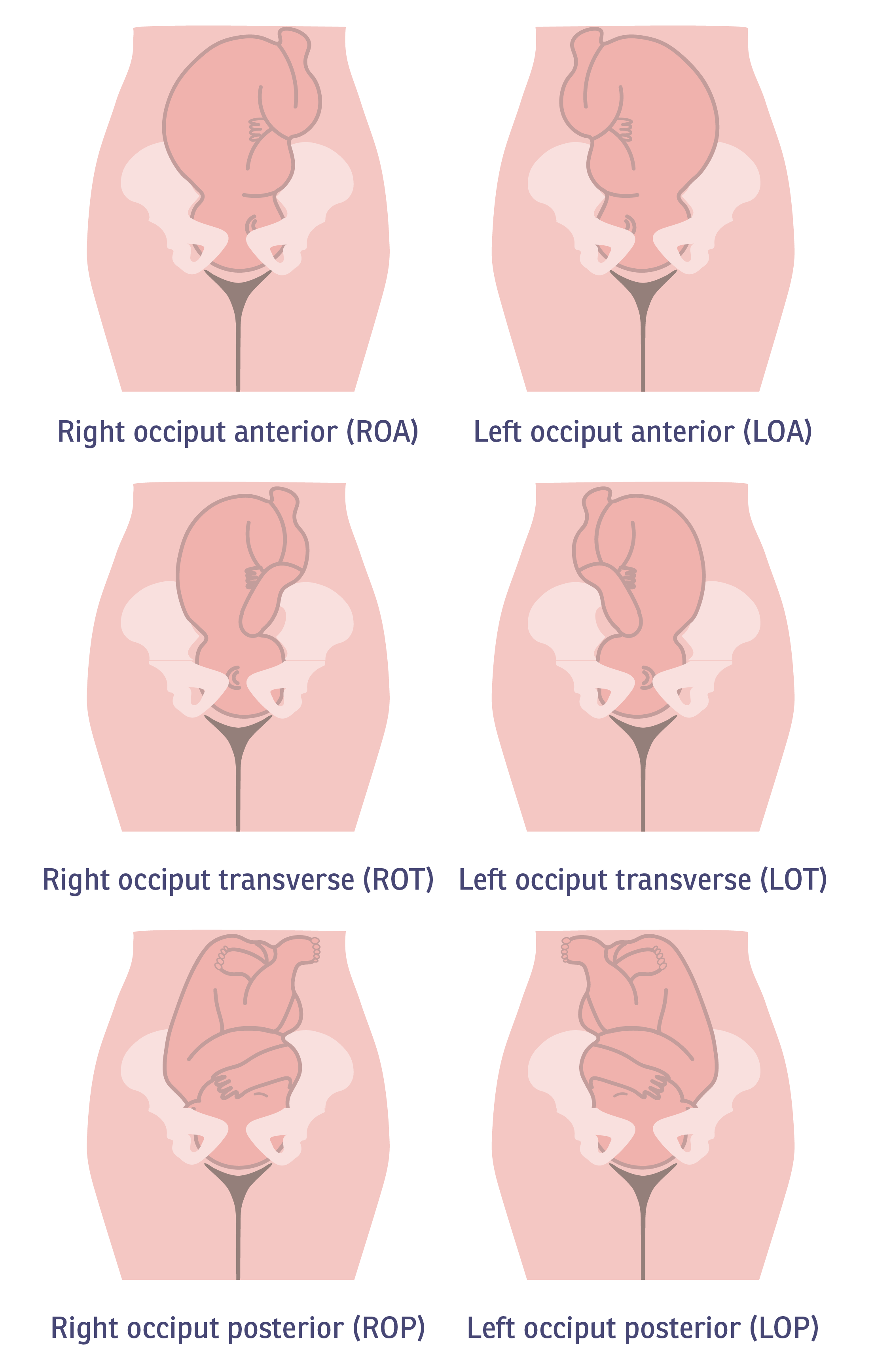 Anterior, lateral and posterior fetal presentations